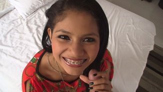 be-careful-with-my-braces